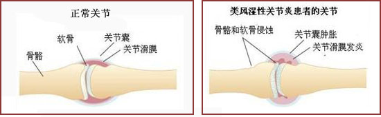 F(yng)(qing)ֱt(y)ԺL(fng)񻼲ԭ.jpg