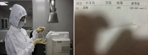 貴陽(yáng)強(qiáng)直醫(yī)院尿酸檢查.jpg